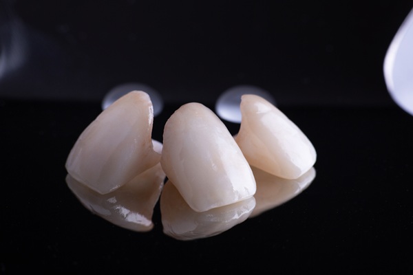 Dental Crowns And Front Teeth: What You Should Know